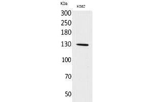 Western Blot analysis of K562 cells using Apaf-1 Polyclonal Antibody. (APAF1 Antikörper  (Internal Region))