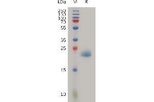 Human PGL Protein, His Tag on SDS-PAGE under reducing condition. (PGLYRP1 Protein (AA 22-196) (His tag))