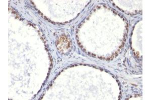 Image no. 1 for anti-Integrin Alpha2b (CD41) antibody (ABIN6156530) (Integrin Alpha2b Antikörper)