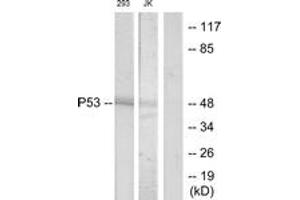 Western Blotting (WB) image for anti-Tumor Protein P53 (TP53) (AA 16-65) antibody (ABIN2889044) (p53 Antikörper  (AA 16-65))