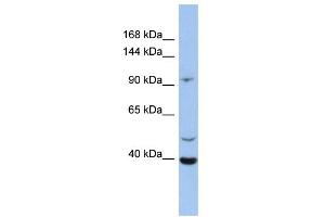 WB Suggested Anti-LRRC37B Antibody Titration:  0. (LRRC37B Antikörper  (N-Term))