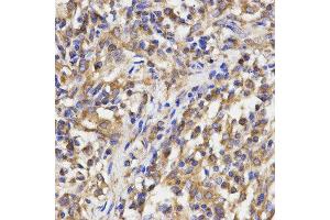 Immunohistochemistry (IHC) image for anti-Ribosomal Protein L5 (RPL5) antibody (ABIN1874650) (RPL5 Antikörper)