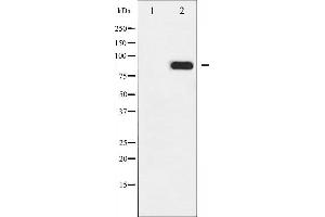 Western blot analysis of IKK- alpha phosphorylation expression in EGF treated MDA-MB-435 whole cell lysates,The lane on the left is treated with the antigen-specific peptide. (IKK alpha Antikörper  (pThr23))