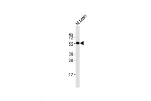 Western Blot at 1:2000 dilution + mouse brain lysates Lysates/proteins at 20 ug per lane. (PRMT3 Antikörper  (N-Term))