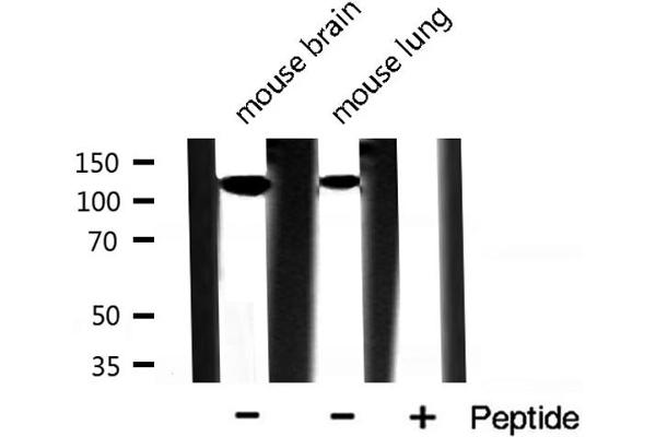 INPP5D Antikörper  (C-Term)