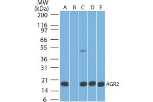 Image no. 1 for anti-Anterior Gradient Homolog 2 (Xenopus Laevis) (AGR2) (AA 50-100) antibody (ABIN1491565) (AGR2 Antikörper  (AA 50-100))