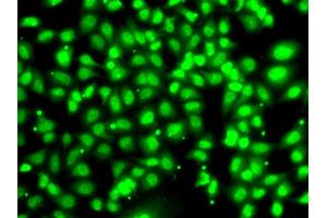 Immunofluorescence analysis of U2OS cells using COPS2 antibody. (COPS2 Antikörper)