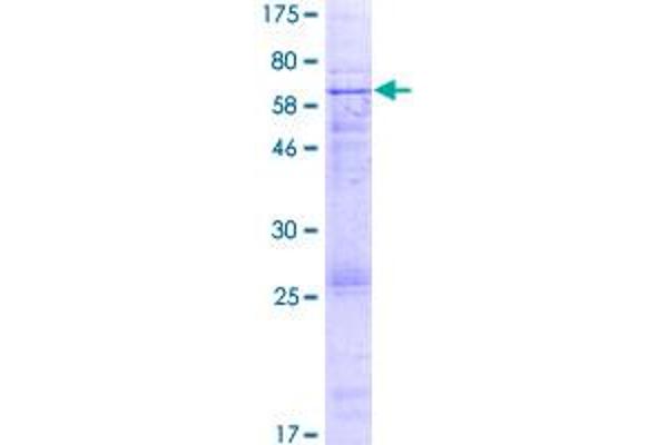 EPHX4 Protein (AA 1-362) (GST tag)