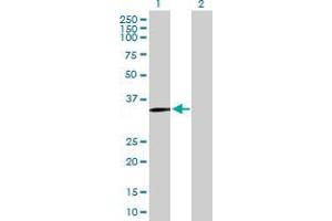 Lane 1: SLC39A13 transfected lysate ( 38. (SLC39A13 293T Cell Transient Overexpression Lysate(Denatured))