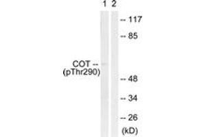 Western blot analysis of extracts from 293 cells treated with UV 15', using COT (Phospho-Thr290) Antibody. (CROT Antikörper  (pThr290))