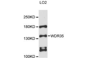 Western blot analysis of extracts of LO2 cells, using WDR35 antibody (ABIN6293806) at 1:3000 dilution. (WDR35 Antikörper)