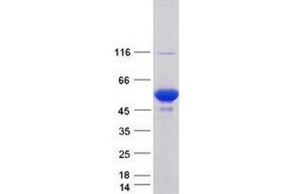 PRKAR1B Protein (Transcript Variant 4) (Myc-DYKDDDDK Tag)