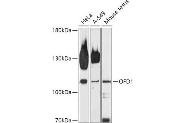OFD1 Antikörper  (AA 763-1012)