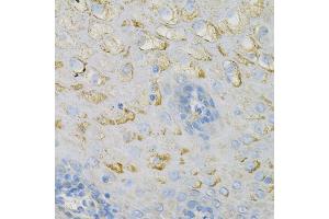 Immunohistochemistry of paraffin-embedded human esophagus using COX4I1 Antibody (ABIN2561975) at dilution of 1:100 (40x lens). (COX IV Antikörper)