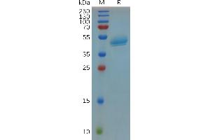 R-Spondin 3 Protein (RSPO3) (AA 22-146) (Fc Tag)