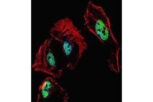 Immunofluorescence (IF) image for anti-Retinoic Acid Receptor, beta (RARB) antibody (ABIN2999994) (Retinoic Acid Receptor beta Antikörper)