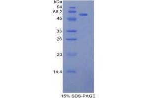 SDS-PAGE analysis of Mouse L1CAM Protein. (L1CAM Protein)