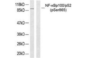 Western blot analysis of extracts from ovary cancer, using NF-kappaB p100/p52 (Phospho-Ser865) Antibody. (NFKB2 Antikörper  (pSer866))