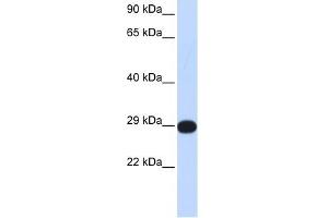 PPP4C antibody used at 1 ug/ml to detect target protein. (PPP4C Antikörper)