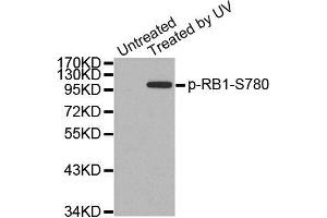 Western Blotting (WB) image for anti-Retinoblastoma 1 (RB1) (pSer780) antibody (ABIN1870571) (Retinoblastoma 1 Antikörper  (pSer780))