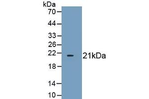 Detection of Recombinant CDKN1A, Mouse using Polyclonal Antibody to Cyclin Dependent Kinase Inhibitor 1A (CDKN1A) (p21 Antikörper  (AA 2-159))