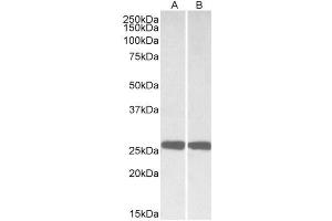 Western Blotting (WB) image for anti-Ubiquitin Carboxyl-terminal Esterase L1 (Ubiquitin Thiolesterase) (UCHL1) (AA 58-68) antibody (ABIN5882512) (UCHL1 Antikörper  (AA 58-68))