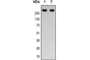 Western blot analysis of p300 (AcK1558/K1560) expression in Jurkat (A), HEK293T (B) whole cell lysates. (p300 Antikörper  (acLys1558, acLys1560))