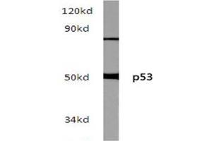 Western blot (WB) analysis of p53 pAb in extracts from hela cells. (p53 Antikörper)