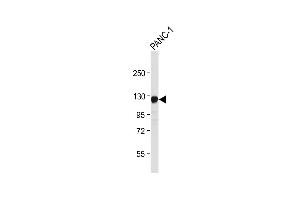 Anti-ROR1 Antibody at 1:4000 dilution + NC-1 whole cell lysate Lysates/proteins at 20 μg per lane. (ROR1 Antikörper)