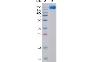 Human EGFR Protein, His Tag on SDS-PAGE under reducing condition. (EGFR Protein (AA 25-645) (His tag))