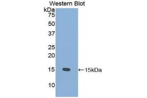 Western blot analysis of the recombinant protein. (PSCA Antikörper  (AA 22-95))