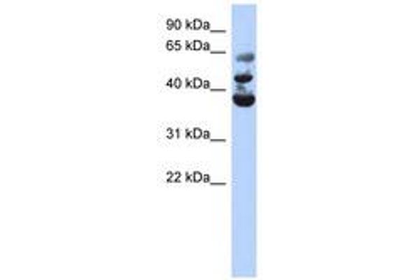 NSUN3 Antikörper  (AA 143-192)