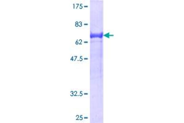 Tensin 1 Protein (TNS1) (AA 1-385) (GST tag)