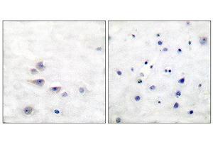 Immunohistochemistry (IHC) image for anti-SHC (Src Homology 2 Domain Containing) Transforming Protein 1 (SHC1) (pTyr427) antibody (ABIN1847216) (SHC1 Antikörper  (pTyr427))