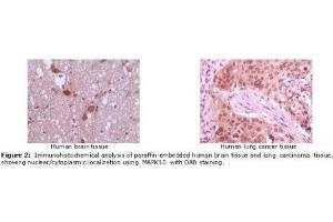 Image no. 2 for anti-Mitogen-Activated Protein Kinase 10 (MAPK10) antibody (ABIN207628) (MAPK10 Antikörper)