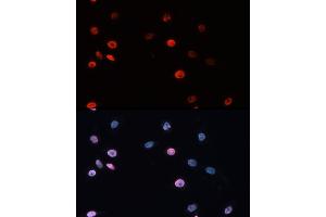 Immunofluorescence analysis of HeLa cells using DNMT3B Rabbit pAb (ABIN3016943, ABIN3016944, ABIN3016945 and ABIN6219896) at dilution of 100 (40x lens). (DNMT3B Antikörper)