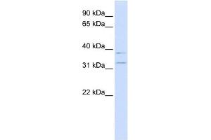 KCNRG antibody used at 1 ug/ml to detect target protein. (KCNRG Antikörper  (N-Term))
