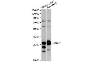 Western blot analysis of extracts of various cell lines, using SNAI2 antibody (ABIN5970416) at 1/1000 dilution. (SLUG Antikörper)