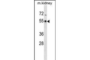 PHKG2 Antibody (ABIN486348 and ABIN1535729) (ABIN6243948 and ABIN6578984) western blot analysis in mouse kidney tissue lysates (35 μg/lane). (PHKG2 Antikörper  (AA 304-334))