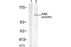 Western blot analysis of extract from 3T3 cell, using FAK (phospho-Tyr397) antibody (E011215, Lane 1 and 2). (FAK Antikörper  (pTyr397))