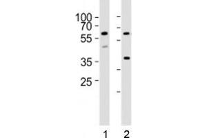 Western blot analysis of lysate from 1) HT-29 and 2) K562 cell lines using RIPK3 antibody at 1:1000. (RIPK3 Antikörper  (AA 61-91))