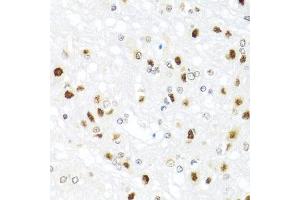 Immunohistochemistry of paraffin-embedded rat brain using GATA2 antibody (ABIN5970251) at dilution of 1/100 (40x lens). (GATA2 Antikörper)