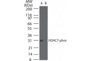 Image no. 1 for anti-Histone Deacetylase 7 (HDAC7) (pSer155) antibody (ABIN225621) (HDAC7 Antikörper  (pSer155))