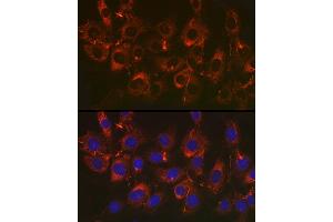 Immunofluorescence analysis of NIH/3T3 cells using Fibronectin Rabbit mAb (ABIN6133698, ABIN6135676, ABIN6135677 and ABIN7101415) at dilution of 1:50 (40x lens). (Fibronectin 1 Antikörper)