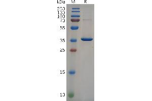 NEFL Protein (AA 89-400) (His tag)