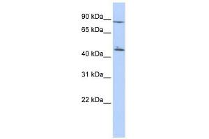 C6ORF199 antibody used at 1 ug/ml to detect target protein. (AKD1 Antikörper  (N-Term))