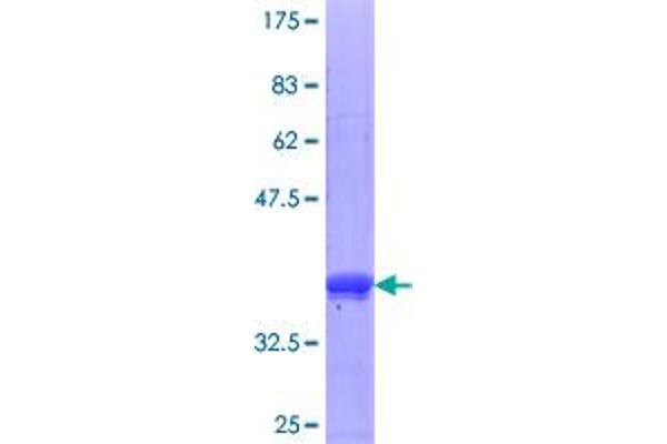 HOXB9 Protein (AA 65-163) (GST tag)