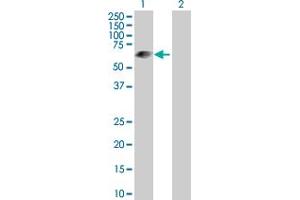 Western Blot analysis of LRIT3 expression in transfected 293T cell line by LRIT3 MaxPab polyclonal antibody. (LRIT3 Antikörper  (AA 1-552))