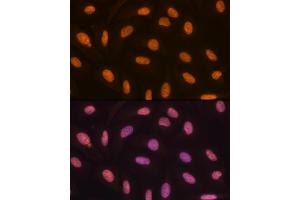 Immunofluorescence analysis of U-2 OS cells using KDM4B/JMJD2B Rabbit mAb (ABIN7268329) at dilution of 1:100 (40x lens). (KDM4B Antikörper)