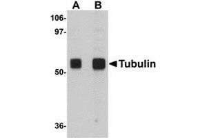 Image no. 1 for anti-alpha Tubulin (TUBA1) (N-Term) antibody (ABIN478060) (alpha Tubulin Antikörper  (N-Term))